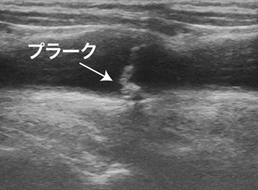 �����d��